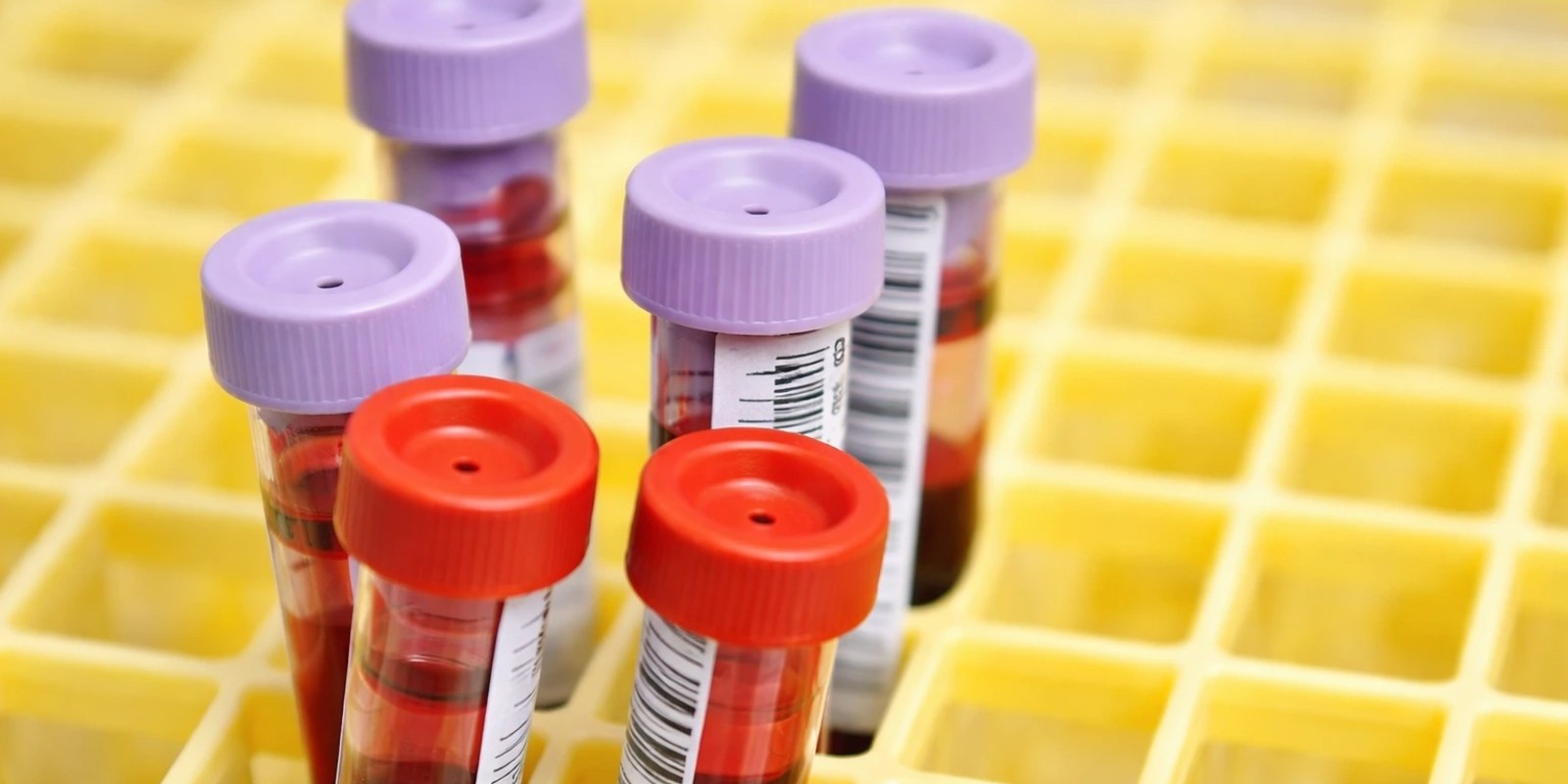 Why Annual Blood Tests Are Essential for Your Health in Dubai