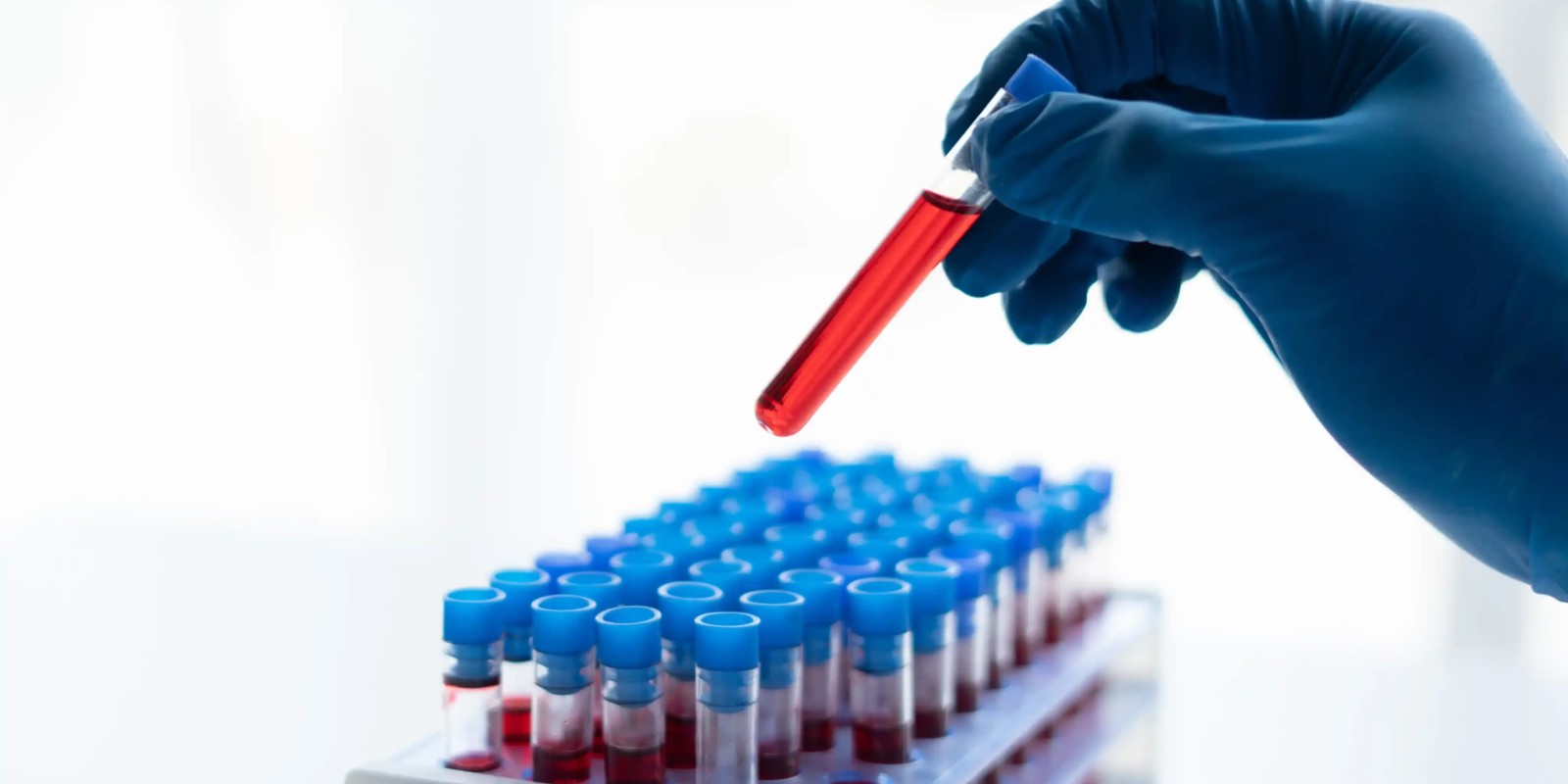 What Blood Tests You Can Easily Get Done at Home in Sharjah