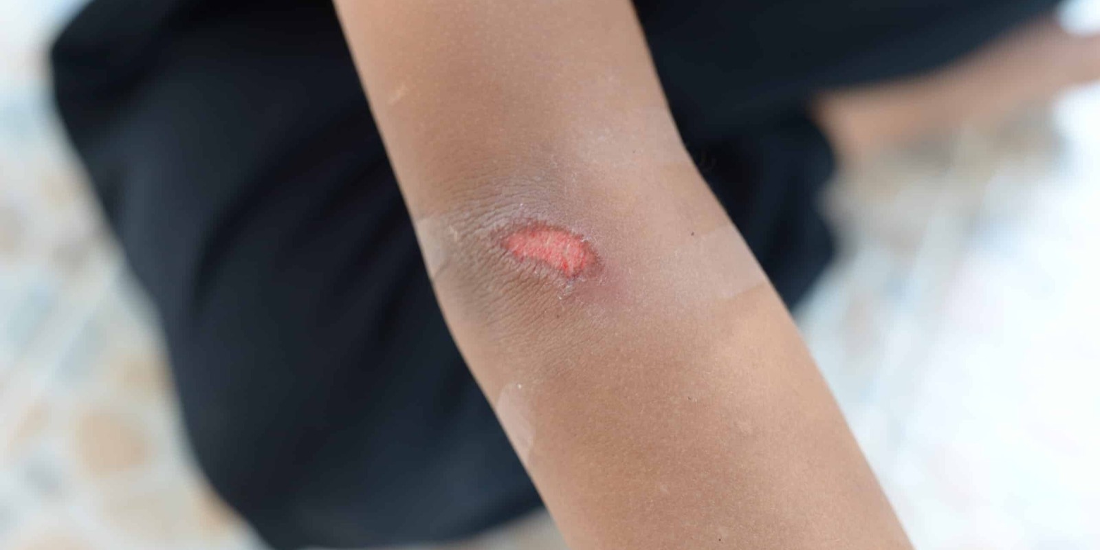 Wound Care in Dubai: A Simple Guide to Safe Healing at Home