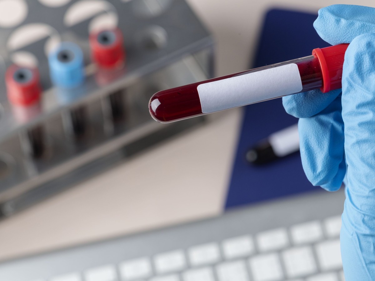 How Much Do Blood Tests at Home Cost in Dubai? A Simple Guide