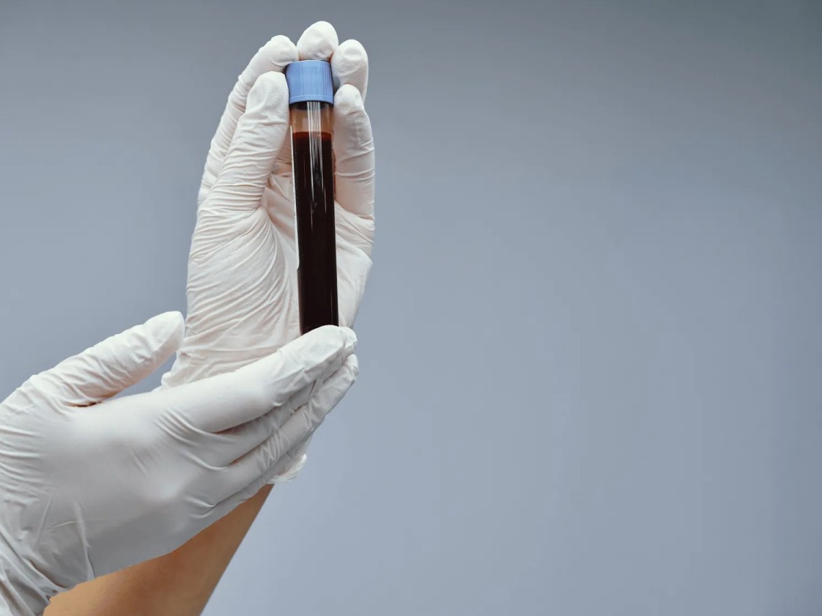 Getting Blood Tests at Home in Dubai: What You Can Check and How It Works
