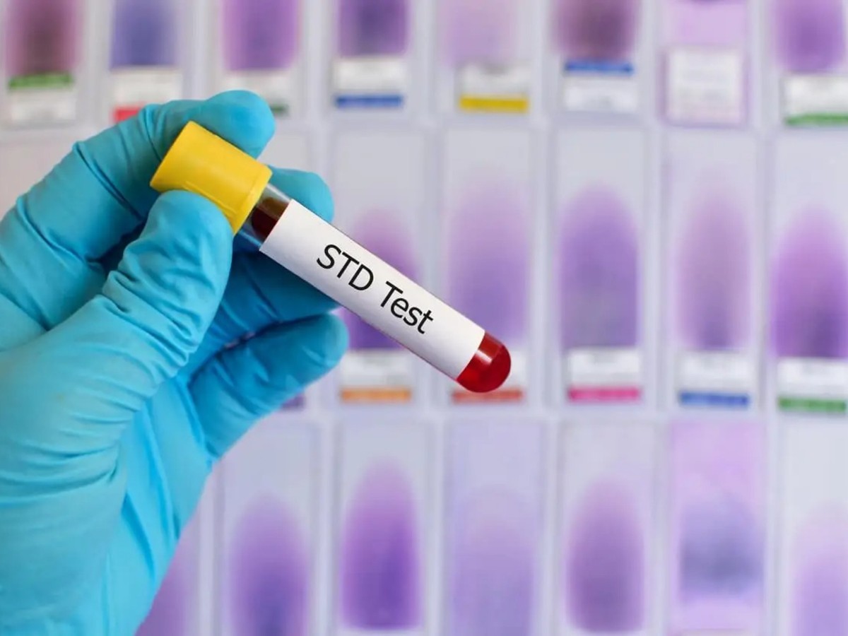 What’s Included in an STD Test in Dubai? A Clear Guide to Screening & Parameters